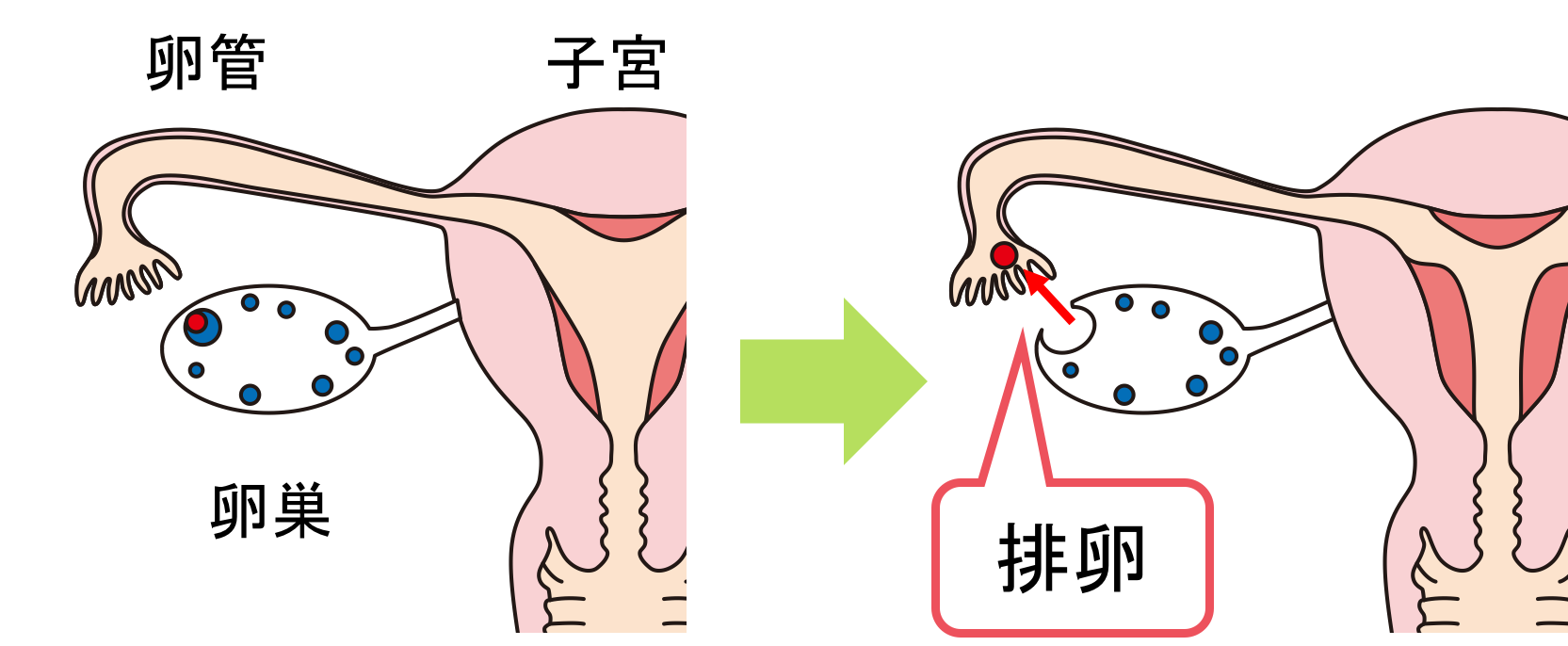 【図解】女性で下腹部が痛い＆腰痛がある時に考えられる病気とは？ お腹の相談所