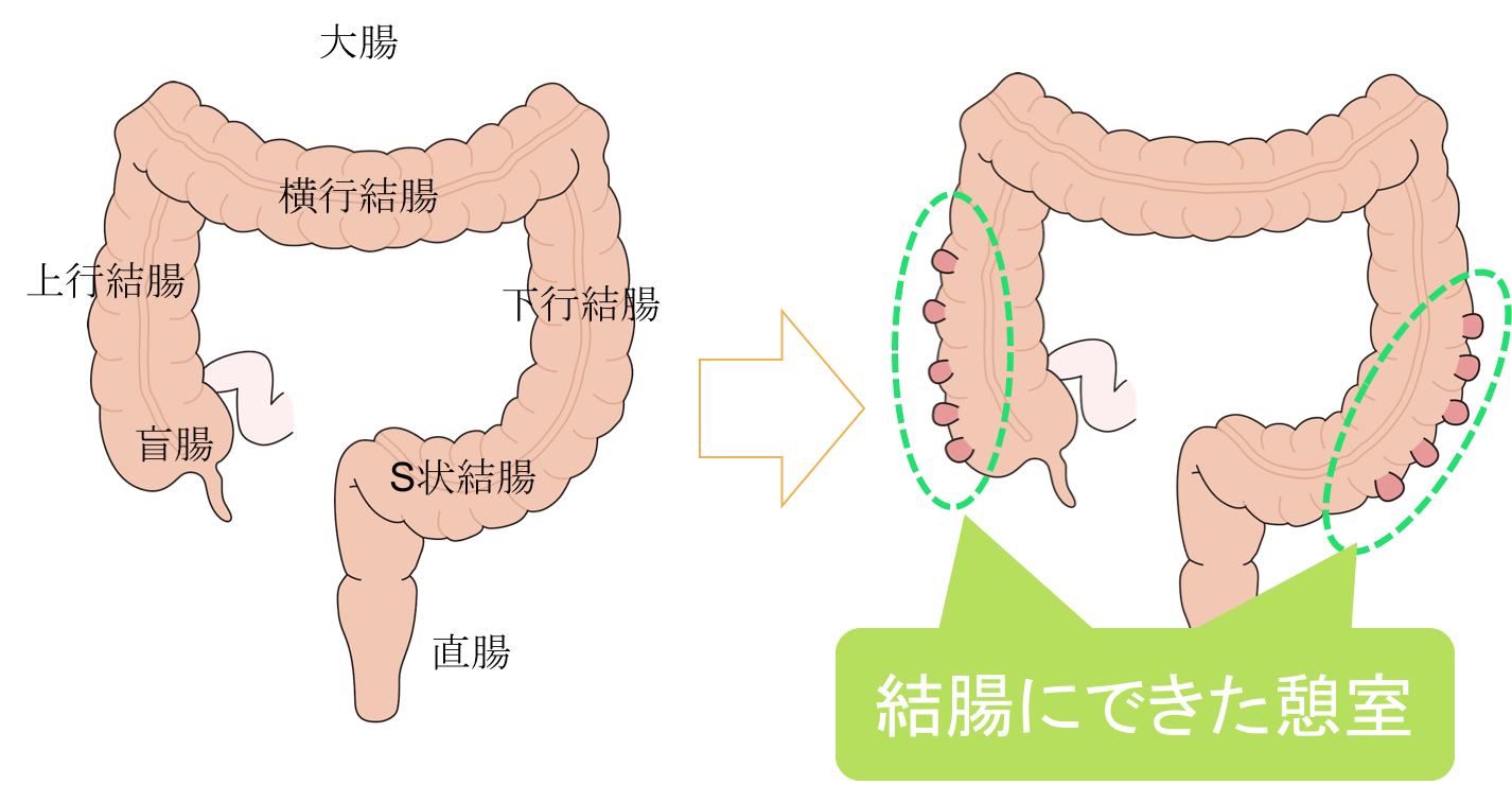 この手術の準備はどのようにすればよいですか?