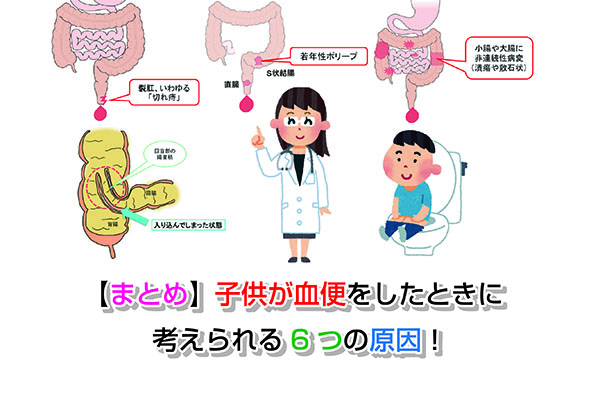 カンピロバクター腸炎の原因・潜伏期間・症状・検査・治療まとめ！