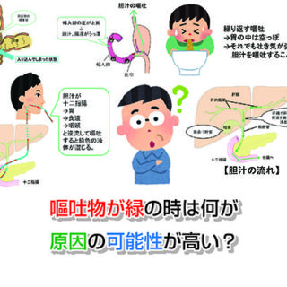 図解 嘔吐物の色が黒い場合の原因まとめ お腹の相談所